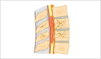 diagram of the spinal cord