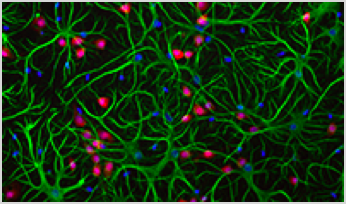 neuronal communication