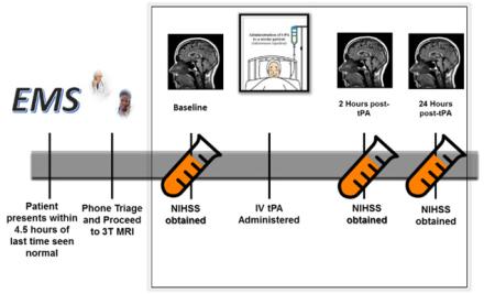Diagram of ischemic stroke on brain MRI